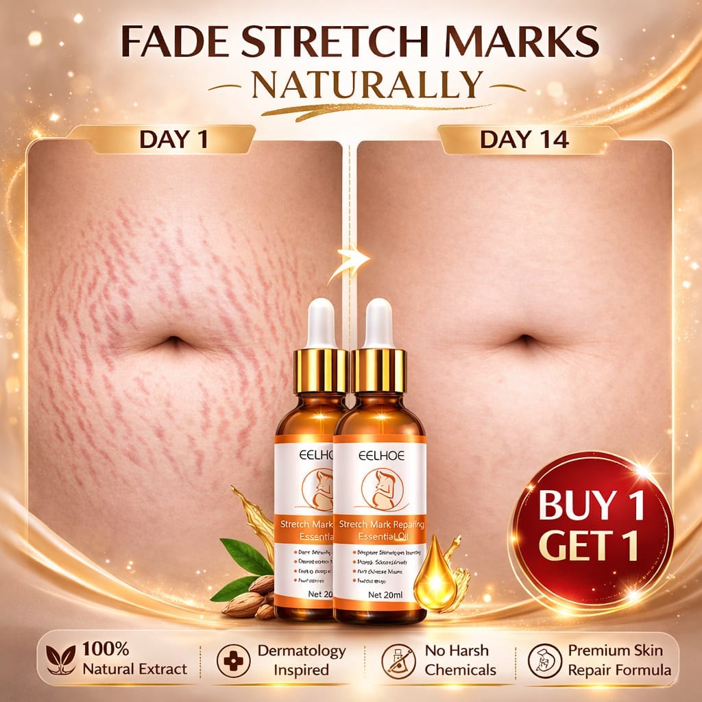 SD Doctor's Approved Stretch Mark Oil – Naturally Effective! 🌿 - dmore