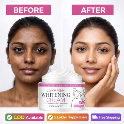 SD Ultimate Brightening Cream- Face, Body & Intimate Care🌸 - dmore