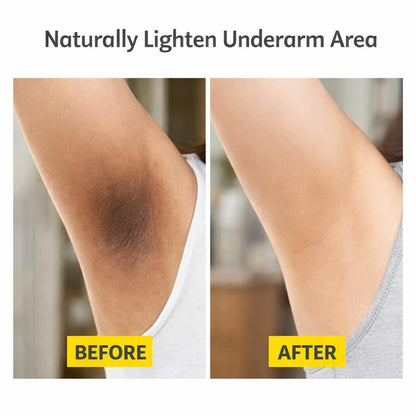 SD Inner Thigh Brightening Cream – Instant Glow, Instant Confidence! 🌿 - dmore