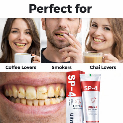 SD Original Intensive Teeth Whitening Toothpaste-🔥Buy 1 Get 1 Free🔥 - dmore
