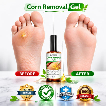 SD Corn Removal Serum 👣 No More Pain, No More Corns - ✨ Buy 1 Get 1 Free ⚡ - dmore