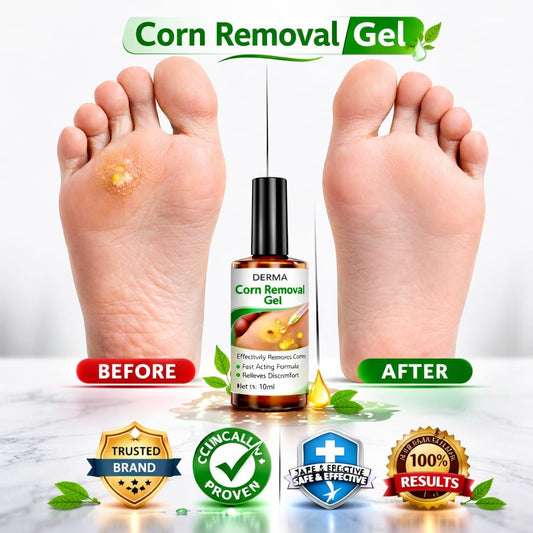 SD Corn Removal Serum 👣 No More Pain, No More Corns - ✨ Buy 1 Get 1 Free ⚡ - dmore