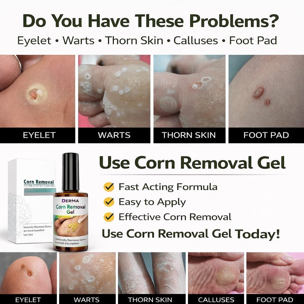 SD Corn Removal Serum 👣 No More Pain, No More Corns - ✨ Buy 1 Get 1 Free ⚡ - dmore