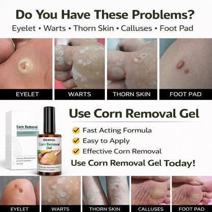 SD Corn Removal Serum 👣 No More Pain, No More Corns - ✨ Buy 1 Get 1 Free ⚡ - dmore