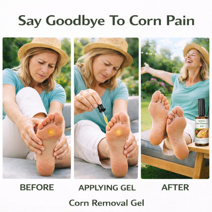 SD Corn Removal Serum 👣 No More Pain, No More Corns - ✨ Buy 1 Get 1 Free ⚡ - dmore