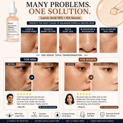SC Pore Perfecting Serum with 10% Lactic Acid