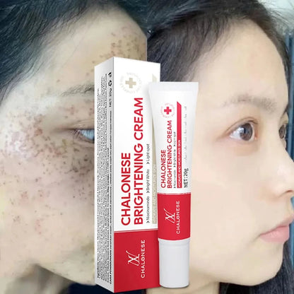 MD Chalonese Brightening Cream – Because Your Skin Deserves to Shine! 🌟 - dmore