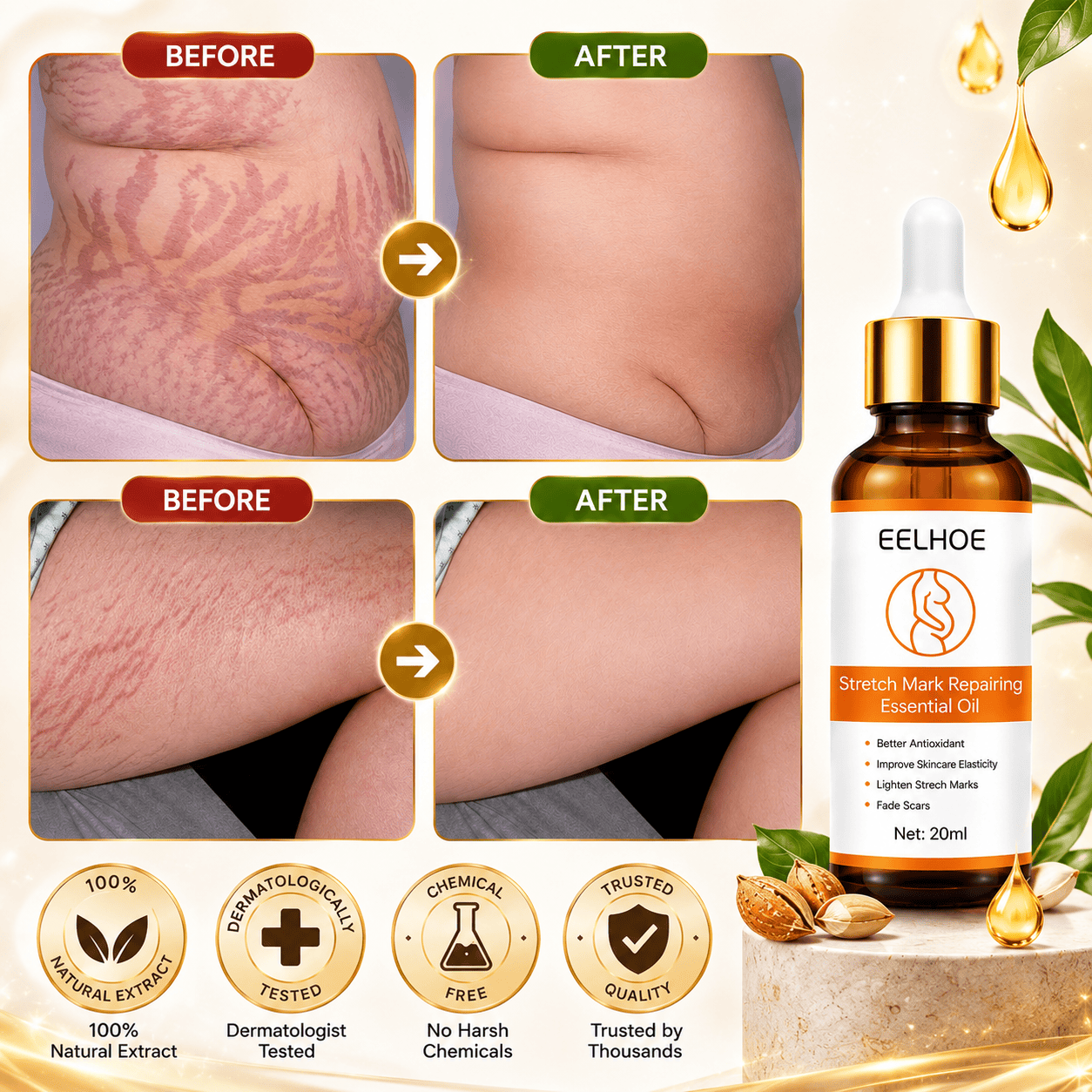 Doctor Approved Stretch Mark Oil Visible Results in just 14 Days