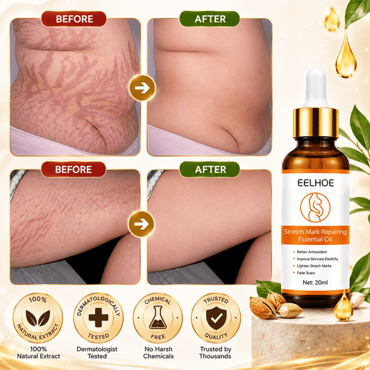Doctor Approved Stretch Mark Oil Visible Results in just 14 Days