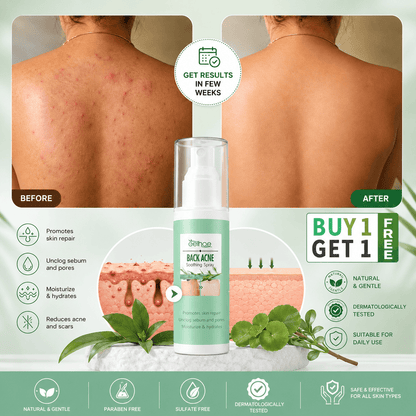 MD Back Acne Spray – Easy, Effective, Acne-Free 🌿 - dmore