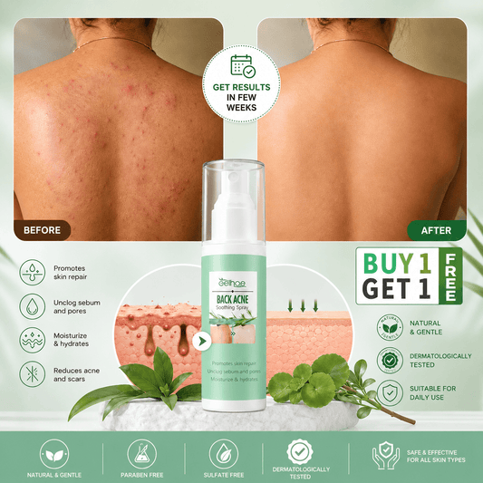 MD Back Acne Spray – Easy, Effective, Acne-Free 🌿 - dmore