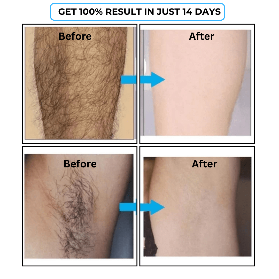 SD Hair Inhibitor Serum – Effortless Hair Reduction 💧 - dmore