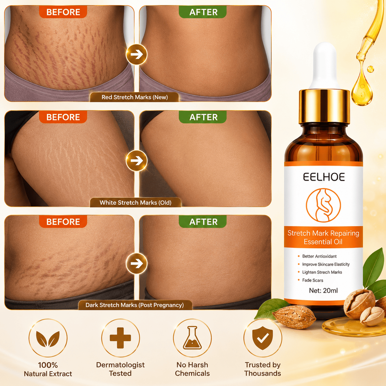 Doctor Approved Stretch Mark Oil Visible Results in just 14 Days