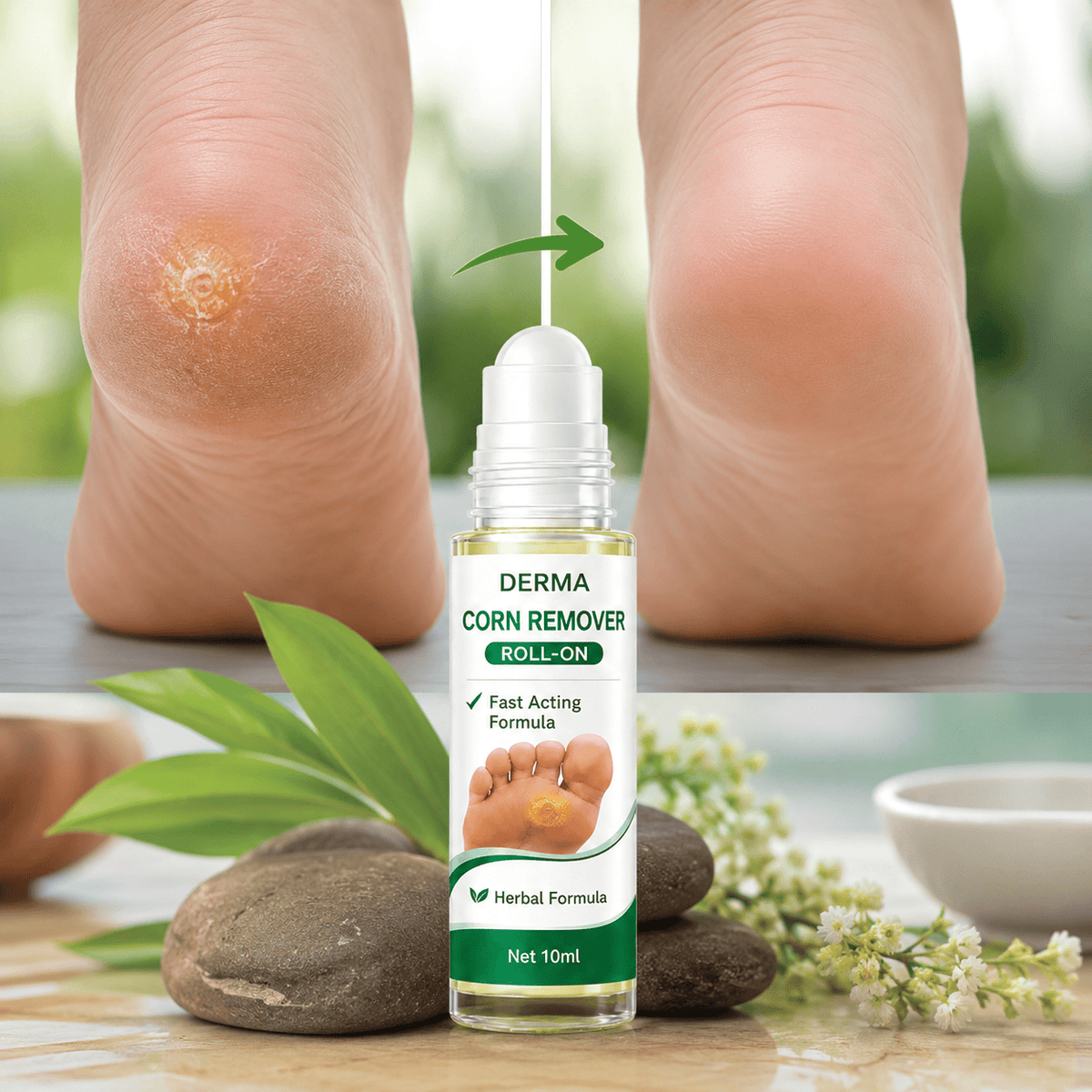 MD Corn Removal Roll On | Targeted Care for Softer, Smoother Feet