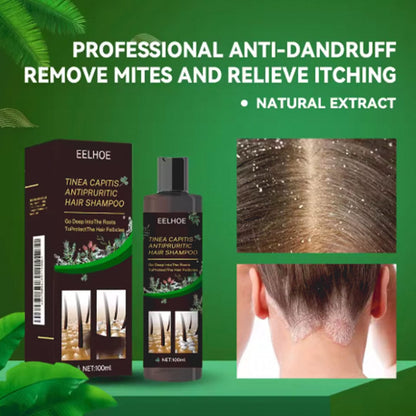 SD Powerful Anti-Dandruff Shampoo for All Hair Types – Smooth, Clean & Fresh Hair Every Wash