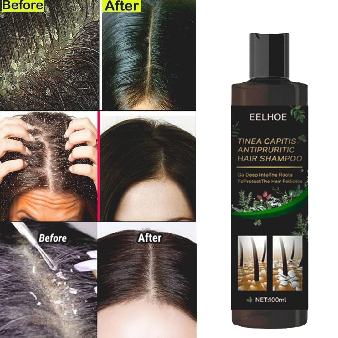 SD Powerful Anti-Dandruff Shampoo for All Hair Types – Smooth, Clean & Fresh Hair Every Wash