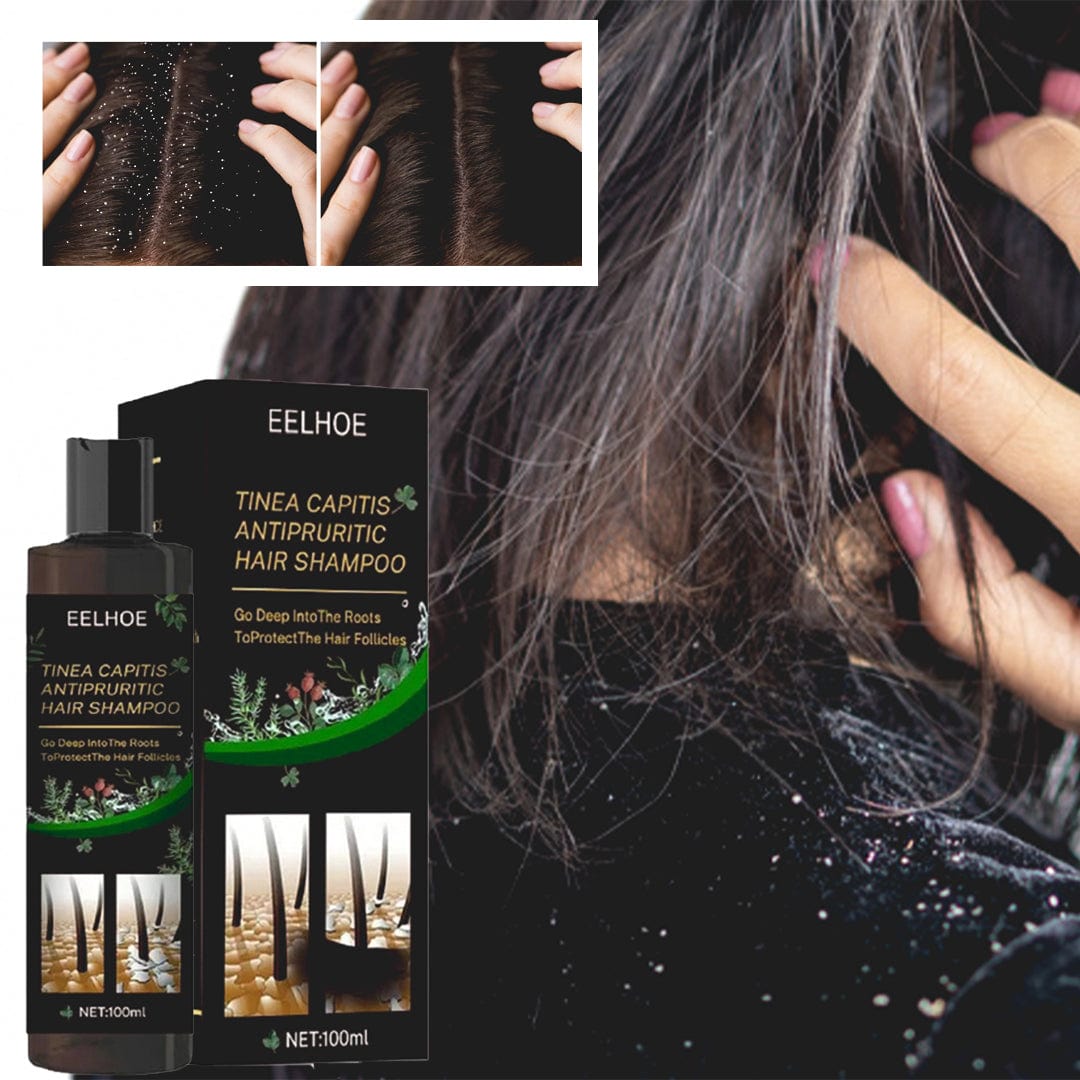 SD Powerful Anti-Dandruff Shampoo for All Hair Types – Smooth, Clean & Fresh Hair Every Wash