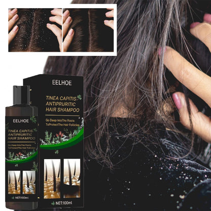 SD Powerful Anti-Dandruff Shampoo for All Hair Types – Smooth, Clean & Fresh Hair Every Wash