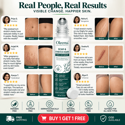 MD Oleema Scar & Stretch Mark Roll-On Serum