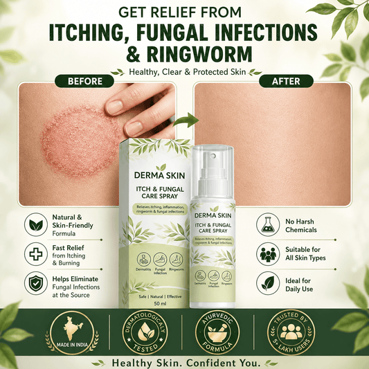 SD Derma Skin Itch & Fungal Care Spray- Dermatologist tested Itch & Fungal Care👨🏽‍⚕️