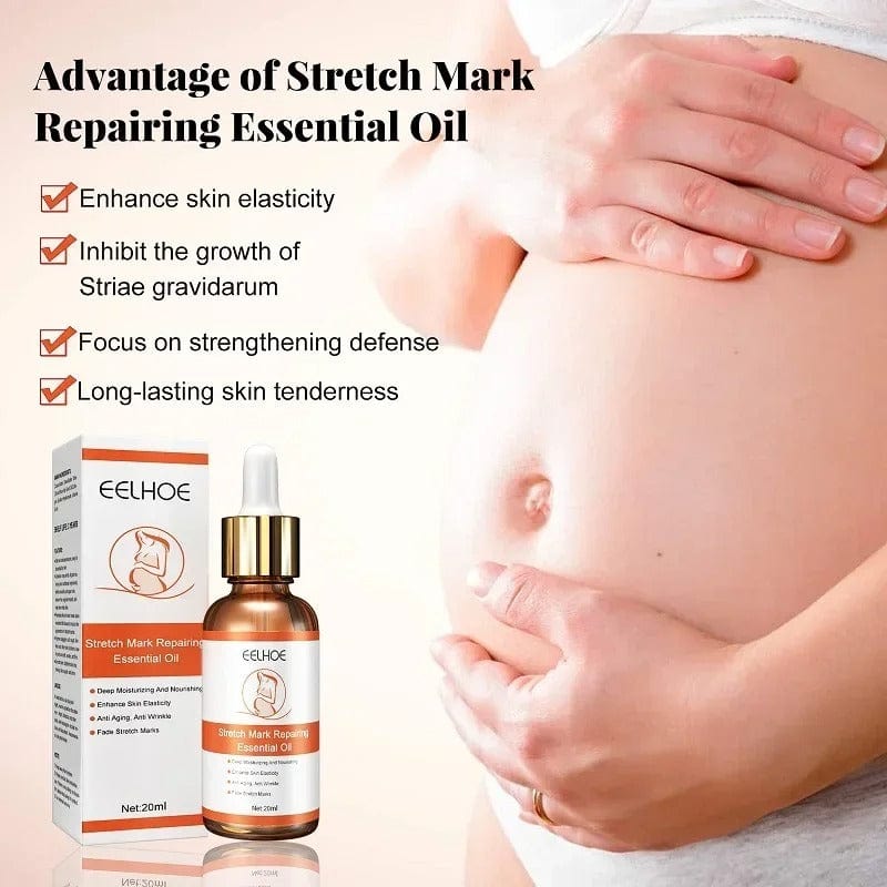 🌿 SC D-More Doctor's Approved Stretch Mark Oil – Naturally Effective! 🌿 - dmore
