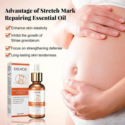🌿 SC D-More Doctor's Approved Stretch Mark Oil – Naturally Effective! 🌿 - dmore