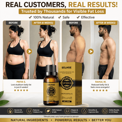SC Belly Drainage Ginger Oil – Lose Belly Fat & Detoxify Naturally✨