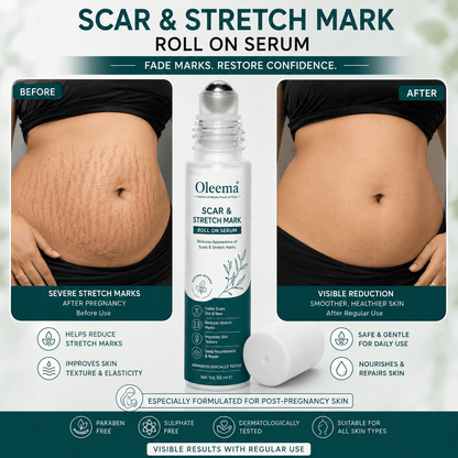 SD Scar & Stretch Mark Roll-On Serum
