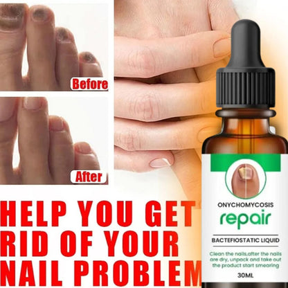 SC D-More All In One Nail Serum 🔥 All Doctors 1st Choice 🔥(Buy 1 Get 1 Free) - dmore