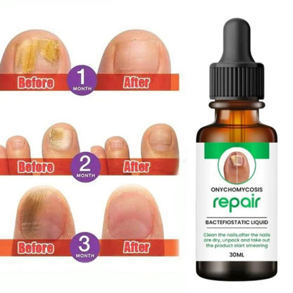 SC D-More All In One Nail Serum 🔥 All Doctors 1st Choice 🔥(Buy 1 Get 1 Free) - dmore
