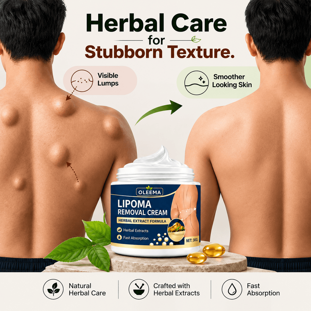 MD Herbal Skin Care Cream for Uneven Skin Texture | Expert-Recommended Formula