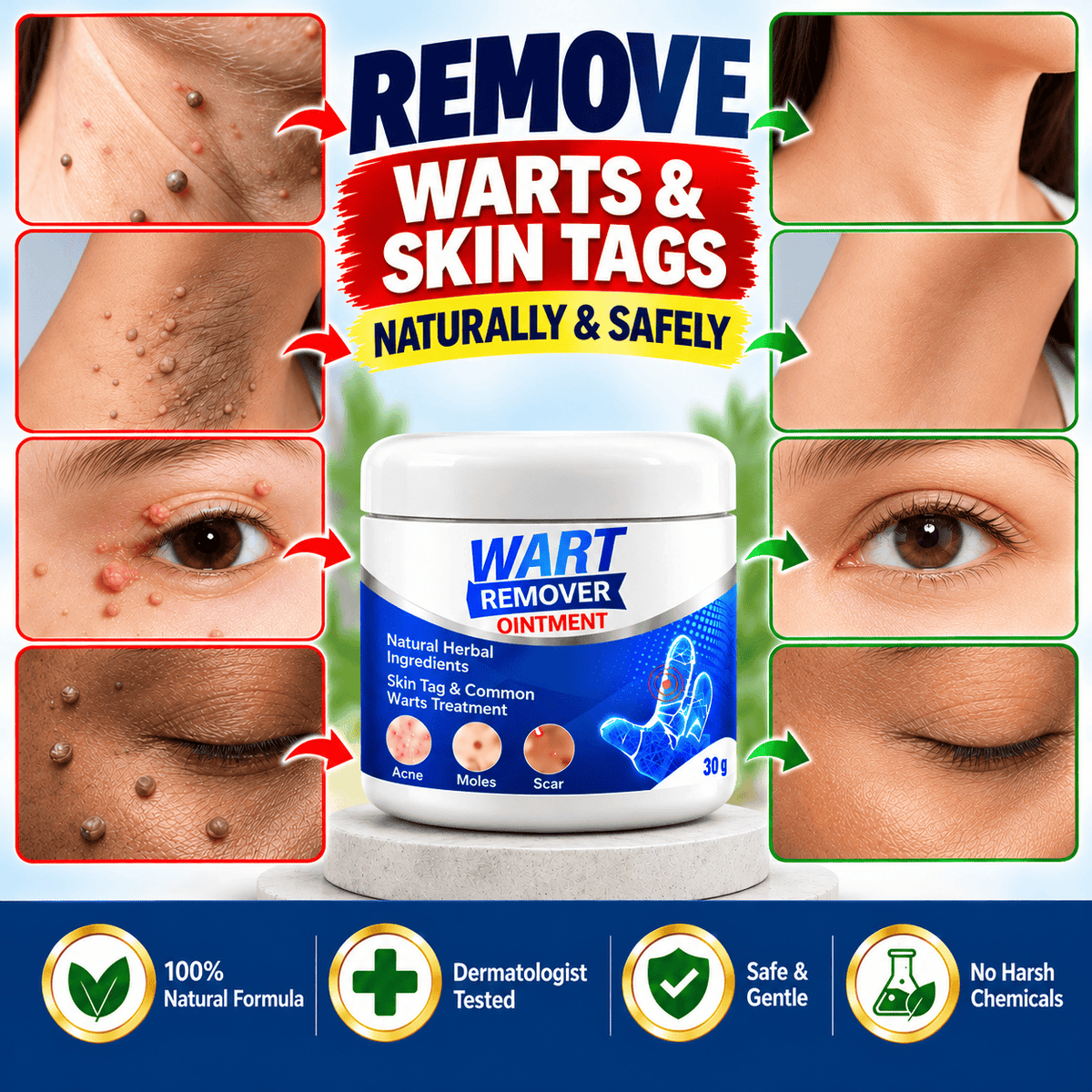 MD Advance Wart Remover cream – Fast & Easy At-Home | Buy 1 Get 1 Free - dmore