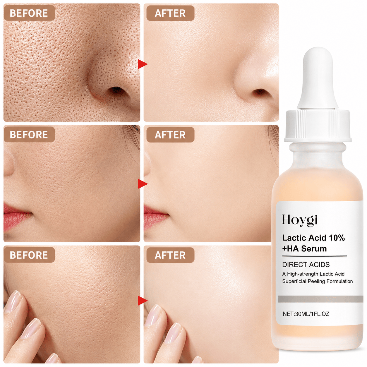 SC Pore Perfecting Serum with 10% Lactic Acid