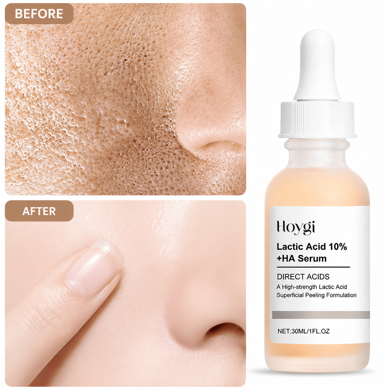 SC Pore Perfecting Serum with 10% Lactic Acid