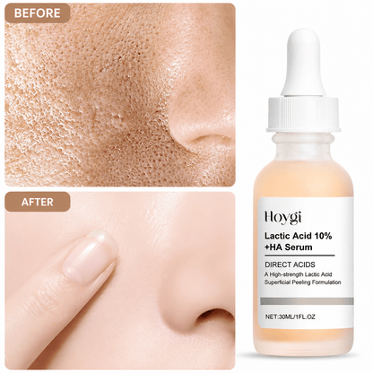 SC Pore Perfecting Serum with 10% Lactic Acid