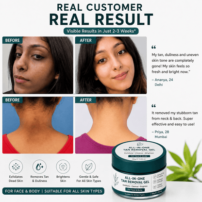 SD ALL-IN-ONE DEAD SKIN REMOVER GEL