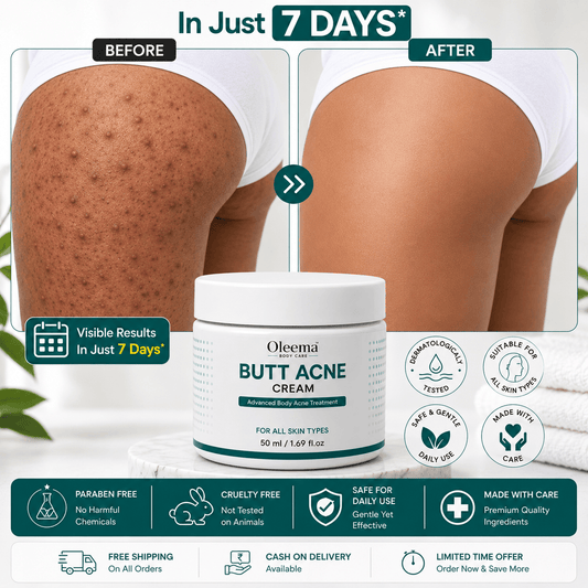 SD Butt Acne Cream For Bumps, Breakouts & Uneven Skin on Your Bum & Body