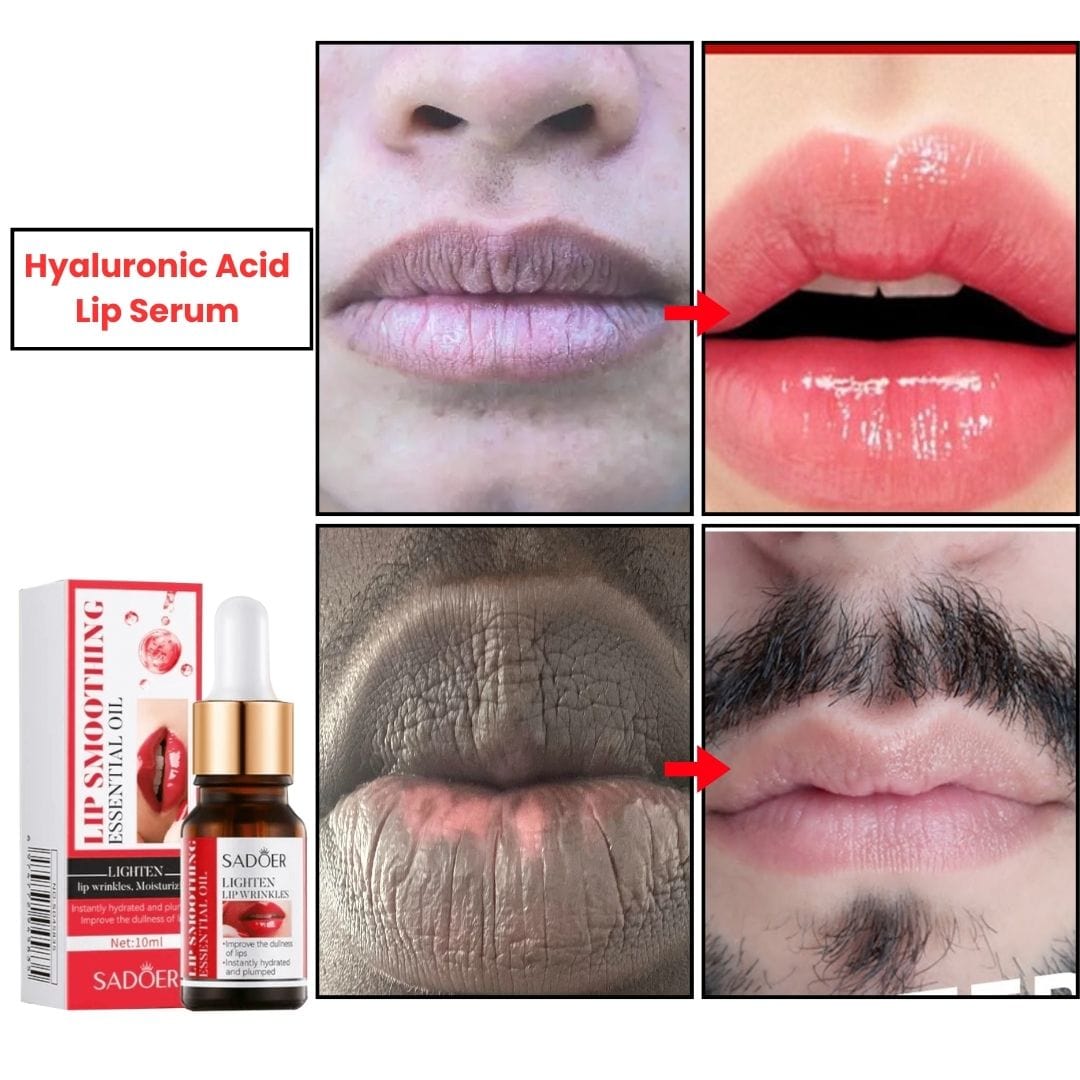 MD Hyaluronic Acid Lip Serum – Your Secret to Plumper Lips! 💋 Buy 1 Ge