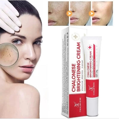 MD Chalonese Brightening Cream – Because Your Skin Deserves to Shine! 🌟 - dmore