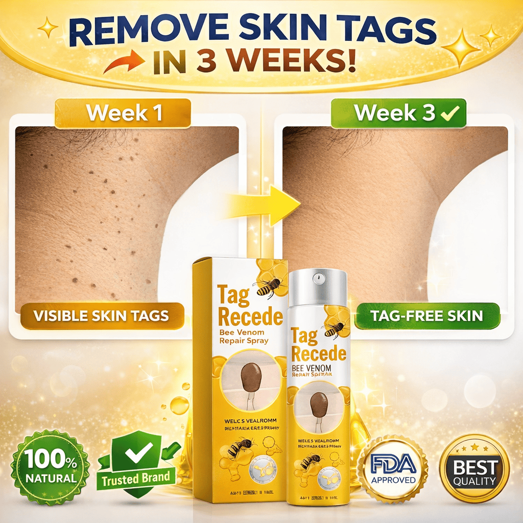 SD Bee Venom Tag & Wart Remover spray - Fast & Easy At-Home in 3 weeks - dmore