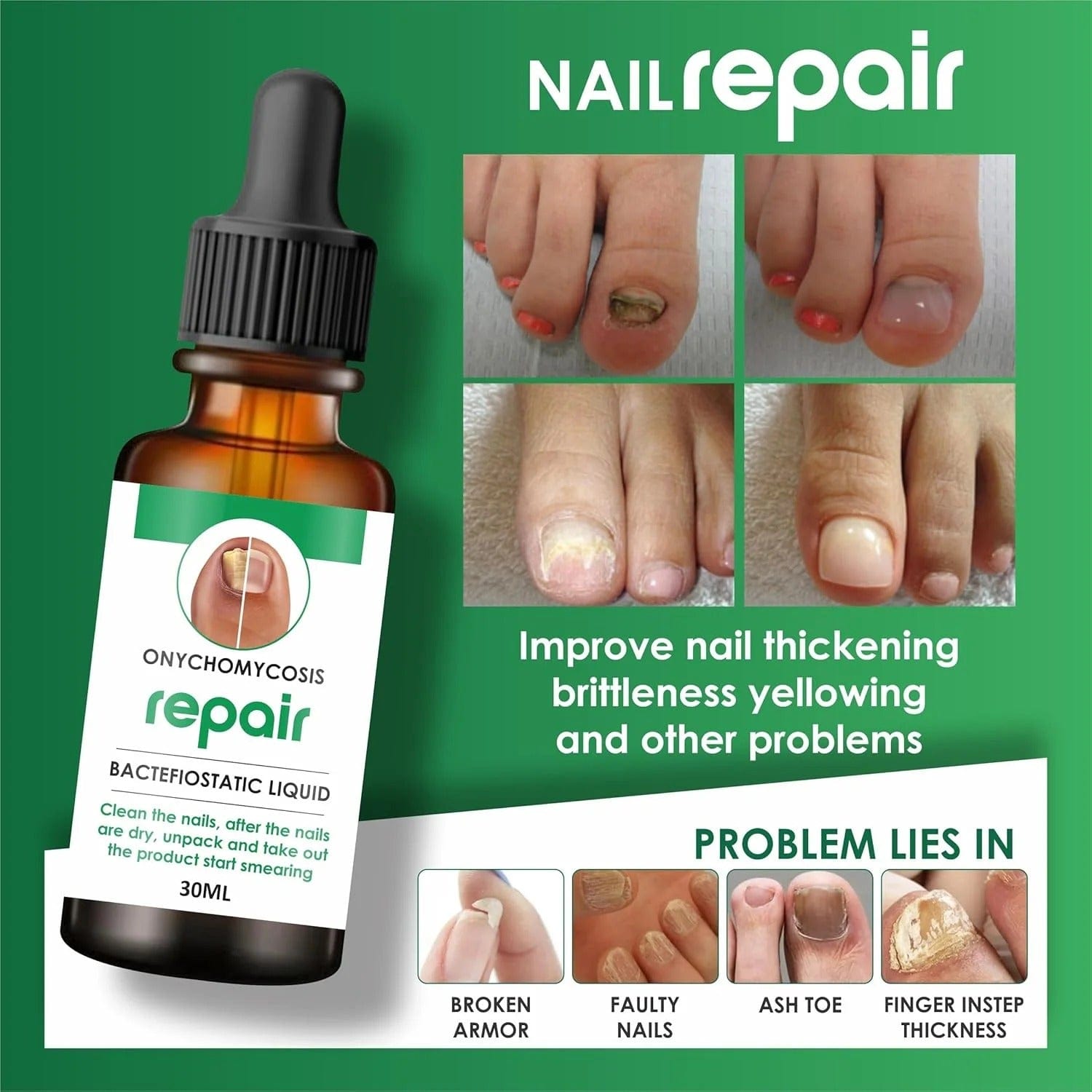 MD Professional All-in-One Nail Serum For Fungal Infection 🔥Buy 1 Get 2 Free🔥 - dmore