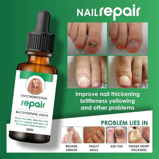 MD Professional All-in-One Nail Serum For Fungal Infection 🔥Buy 1 Get 2 Free🔥 - dmore