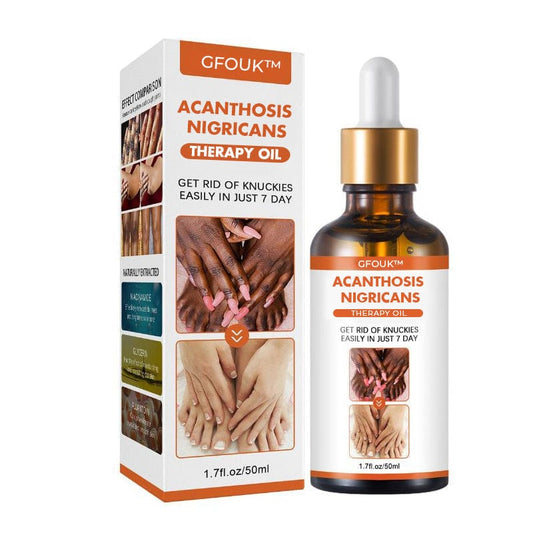 SD Acanthosis Nigricans Oil – The Herbal Solution for Dark Patches🌿 - dmore