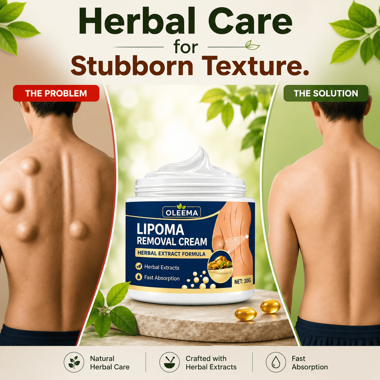 MD Herbal Skin Care Cream for Uneven Skin Texture | Expert-Recommended Formula