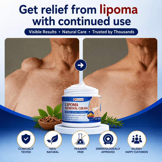 MD Herbal Lipoma Cream | Expert-Recommended Herbal Skin Formula ⭐