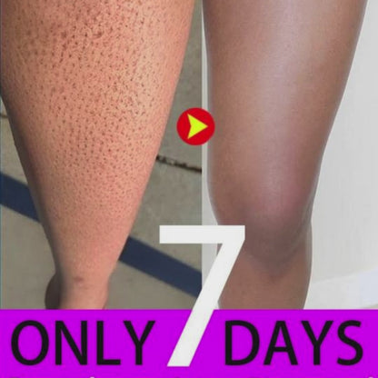 SD Strawberry skin removing cream - Buy 1 Get 1 Free 🔥