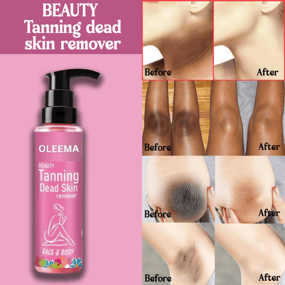 MD Oleema Beauty Tanning Dead Skin Remover-🔥Buy 1 Get 1 Free 🔥(100% Money Back) - dmore