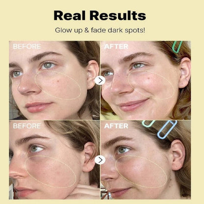 SD Ultra Glow Vitamin C Serum with Korean Anti-Aging Formula🌿 - dmore