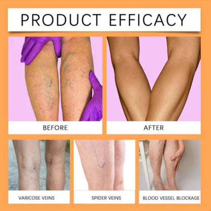 MD Leg Pain Gone, Confidence On 🔥 Buy 1 Get 1 FREE 🔥 - dmore